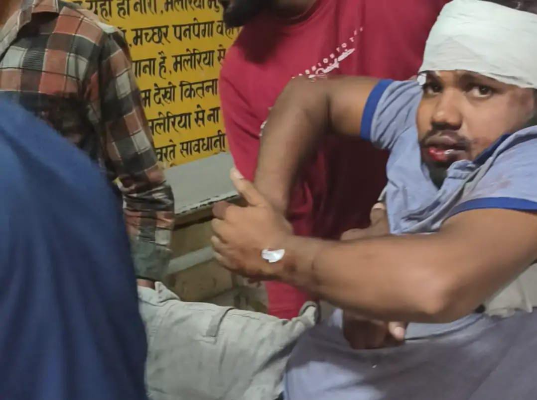 Road Accident: कुत्ते को बचाने में हुआ हादसा, अनियंत्रित होकर फिसली बाइक, युवक गंभीर रूप से घायल