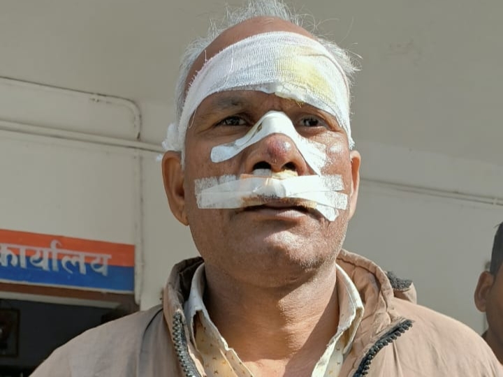 Bulandshahr: नहर की रेत बनी सड़क का खतरा, बाइक से फिसलकर गिरे दंपति, गंभीर रूप से घायल