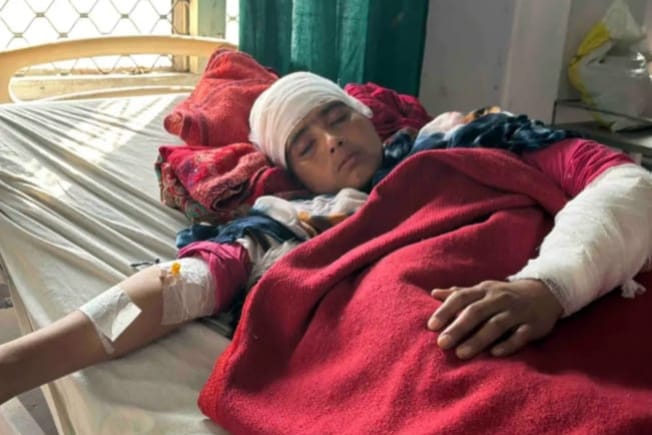 घर के सामने शराब पीने से रोका तो भड़के देवर-देवरानी, भाभी पर धारदार हथियार से हमला, हालत गंभीर
